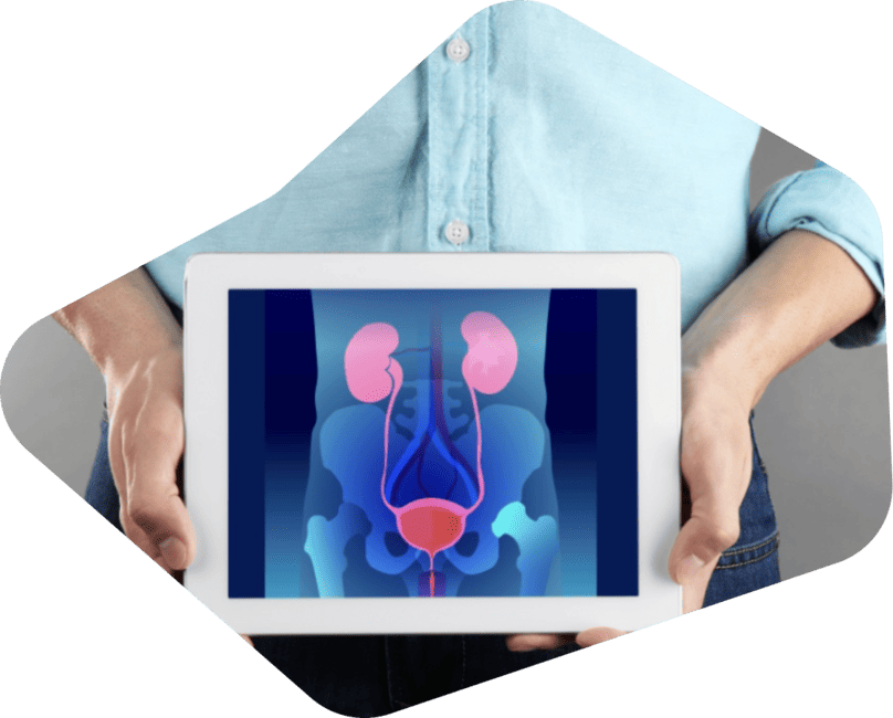 Urología en Merida