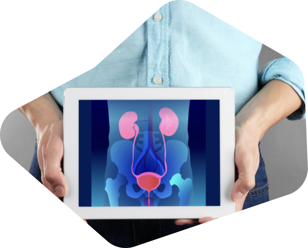 Urología en Merida